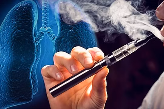 Thuốc lá điện tử đang là "mối hoạ" cho thế hệ tương lai đất nước
