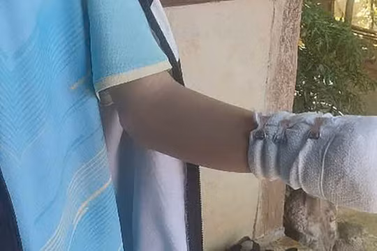 Cảnh báo hiểm họa từ việc tự chế tạo pháo tại tỉnh Đắk Lắk và Đắk Nông