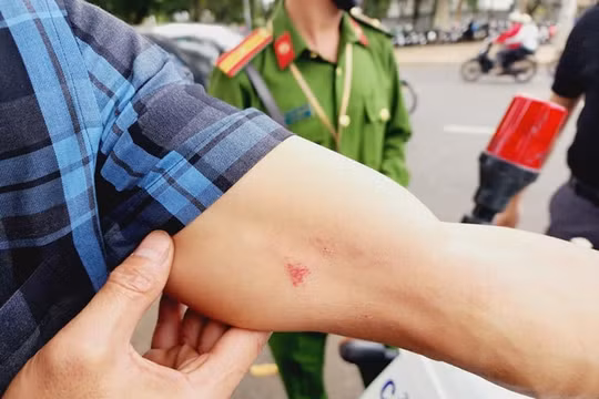 Cơ quan Công an đang xác minh, làm rõ vụ phóng viên Báo CAND bị hành hung khi tác nghiệp