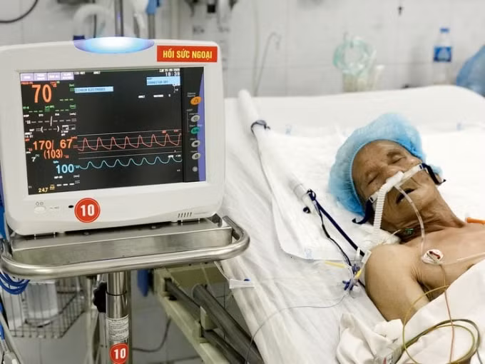 Máy thở là thiết bị y tế cần thiết phục vụ việc chữa bệnh cho bệnh nhân Covid-19. Ảnh: TL.