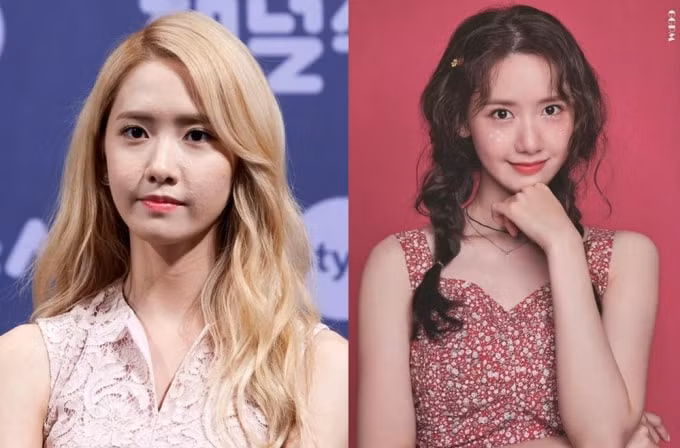 "Quốc bảo nhan sắc" Yoona của SNSD cũng từng dính phải "lời nguyền" làn da xấu (Ảnh Koreaboo)