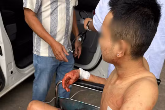 Truy bắt kẻ đâm hai thanh niên trước quán bida ở Bình Dương