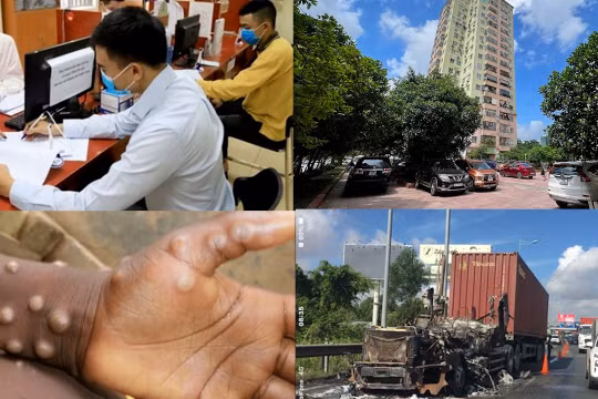 Nóng 18h: TP.HCM phát hiện vài ca đậu mùa khỉ trong hai tuần, có đáng lo?