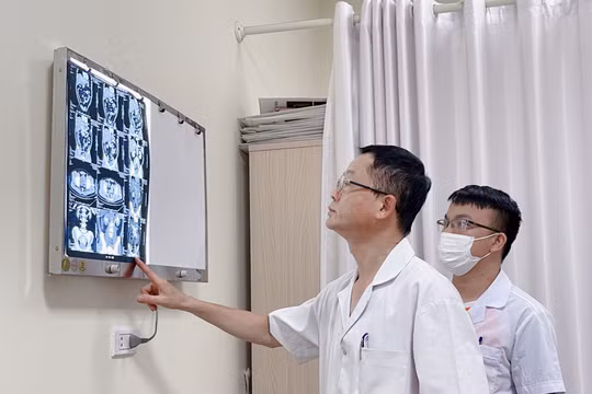 Khi đau ở vùng thắt lưng kéo dài, dấu hiệu của bệnh ung thư nào?