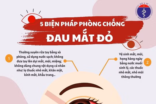 Đau mắt đỏ lây lan nhanh: Bộ Y tế khuyến cáo biện pháp phòng ngừa, điều trị