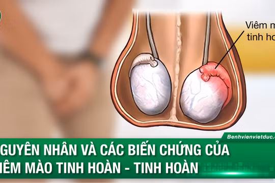 Bác sĩ tiết lộ lý do bệnh lý khiến nhiều quý ông suy giảm chức năng đàn ông