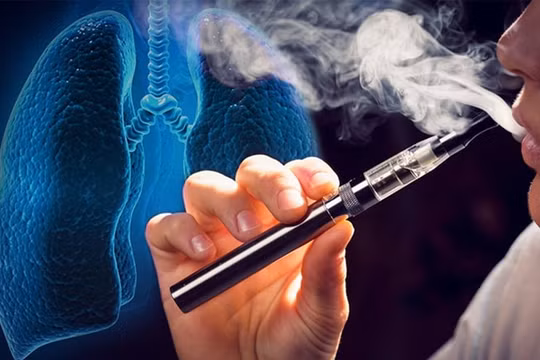 Cần cấm ngay việc sản xuất, nhập khẩu, lưu thông và sử dụng thuốc lá điện tử
