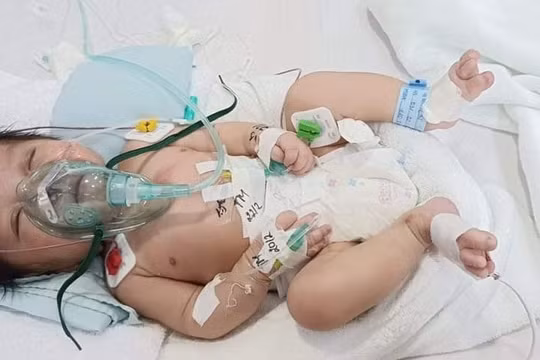 Nghị lực sống mãnh liệt của bé trai 2 tháng tuổi bị mắc bệnh tim bẩm sinh