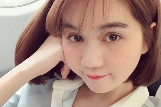 Những nét "dị tướng" mang lại vận vượng phát bất ngờ