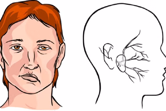 Vận mệnh và tính cách của người tướng mặt lệch