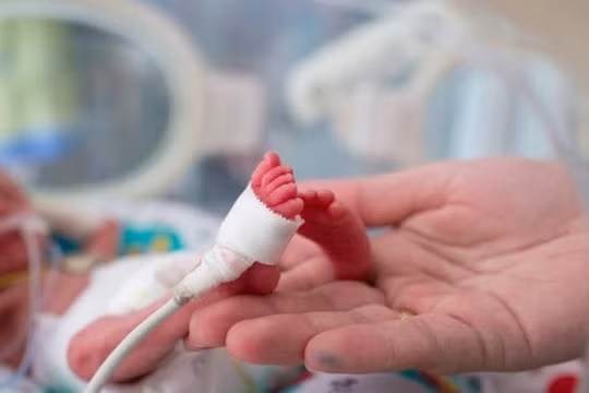 Bệnh viện Phụ sản Hà Nội: Cứu sống thành công bé gái sinh non nặng 400g