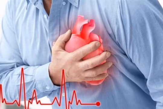 Bác sĩ tiết lộ giờ vàng để điều trị bệnh nhồi máu cơ tim