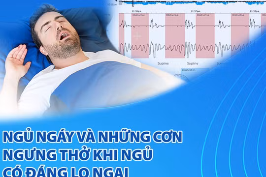 Ngáy ngủ là bệnh lý, nhiều nguy cơ có hại cho sức khỏe