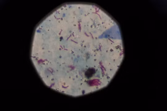 Biến đổi khí hậu tác động đến cuộc chiến chống lại AIDS, lao và sốt rét