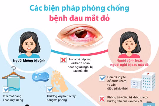 Đau mắt đỏ, sốt xuất huyết đang vào mùa