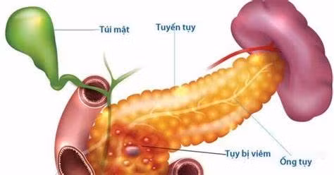 Bệnh lý tuyến tụy liên quan đến rượu và ăn uống