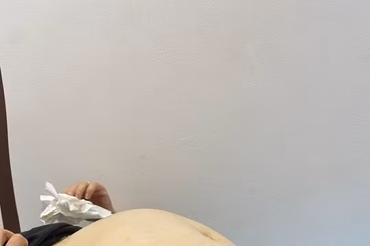 Bệnh viện Phụ sản Hà Nội: Phẫu thuật thành công u nhầy buồng trứng nặng 8 kg