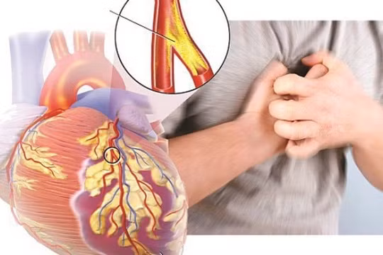 Người suy tim có dấu hiệu như nào?