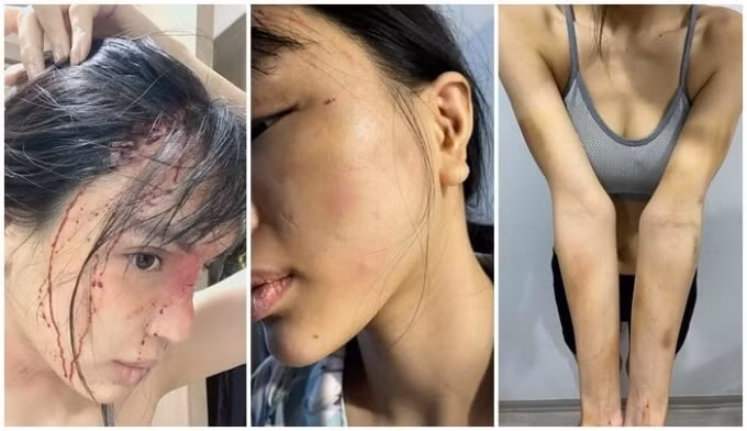 nguoi mau kha trang bi bao hanh da man hinh 1