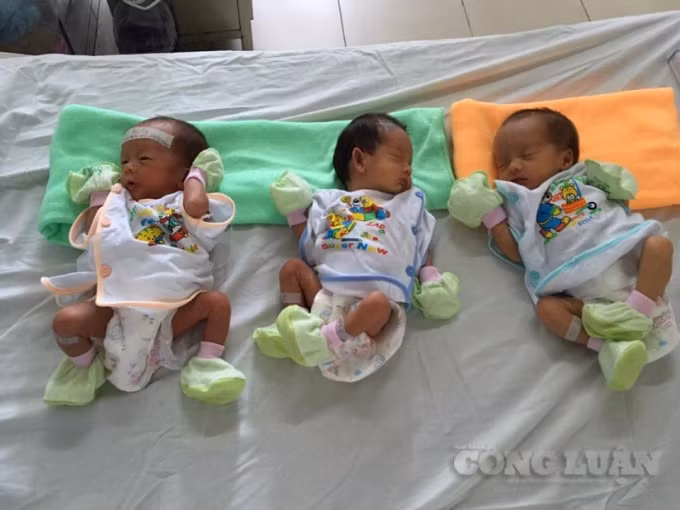 Ca sinh ba hiếm gặp vượt cạn thành công ngoài mong đợi- Ảnh: Nhật Tân.
