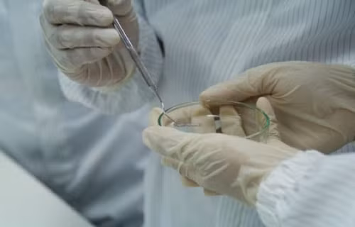 Stent mạch vành.