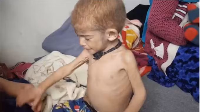nan doi dang hoanh hanh o afghanistan hinh 1
