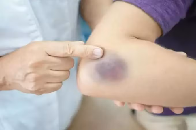 nhung dau hieu keu cuu tu gan ban khong nen bo qua hinh 4