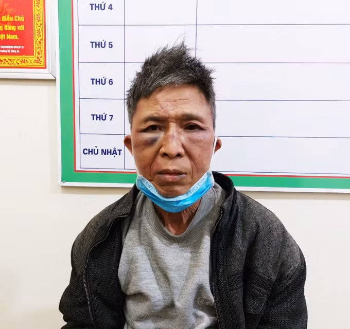 3 chien si cong an o ha giang bi thuong khi truy bat toi pham ma tuy hinh 1