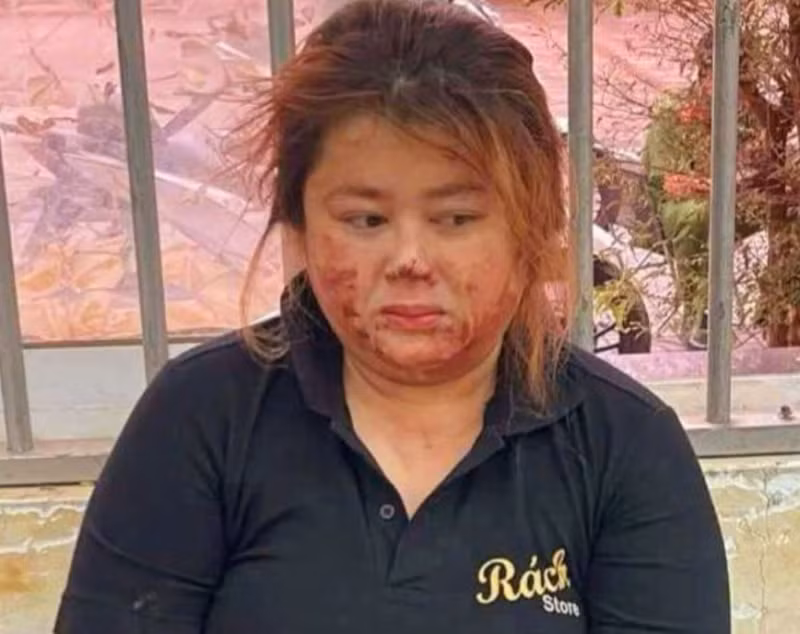bat doi tuong dung dao dam chong ho tu vong hinh 1