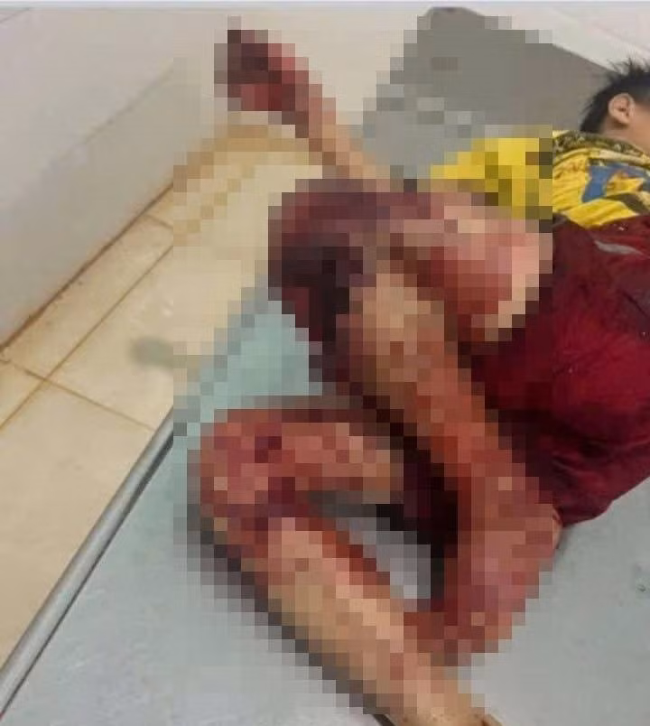 gia lai mua nguyen lieu ve nha tu che tao phao 4 hoc sinh bi thuong hinh 1