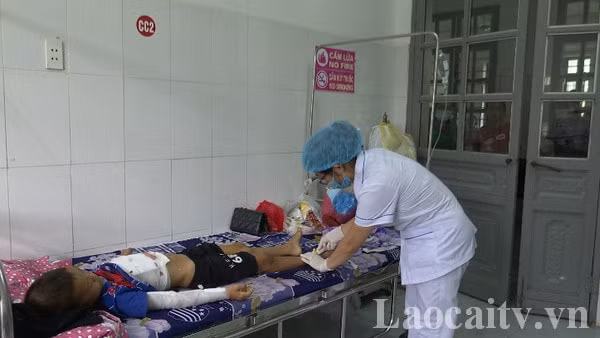 Cháu T.H.V. bị thương do cắm vật lạ vào ổ điện phát nổ nên bị thương nặng phải vào bệnh viện đa khoa huyện Bát Xát cấp cứu. (Ảnh Đài PTTH Lào Cai).