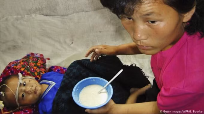 Nạn đói và suy dinh dưỡng đã từng xảy ra ở Bắc Triều Tiên trước thời kỳ kinh tế kiệt quệ như hiện nay.