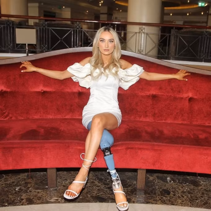 Bernadette là người mẫu và cũng là thí sinh đầu tiên bị cụt chân tiến vào chung kết Hoa hậu Bắc Ireland.