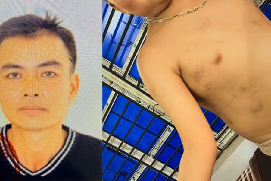 Phú Thọ: Bắt tạm giam người cha bạo hành con trai hơn 7 tuổi