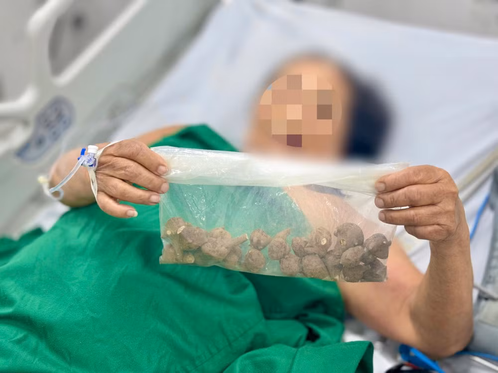 Do đau tái phát, bà đặt mua “củ ấu tầu” qua mạng– hàng được gửi từ vùng cao, với mục đích nấu nước uống chữa khớp.