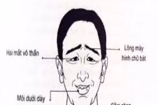 Những nét tướng của đàn ông nghèo khổ, chật vật, thiếu thốn
