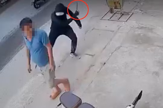 Công an truy nã đối tượng chém lìa chân người đàn ông ở Hà Nội
