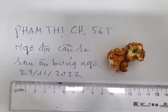 Một phụ nữ nhập viện vì ăn bỏng ngô nghi bị tẩm cần sa