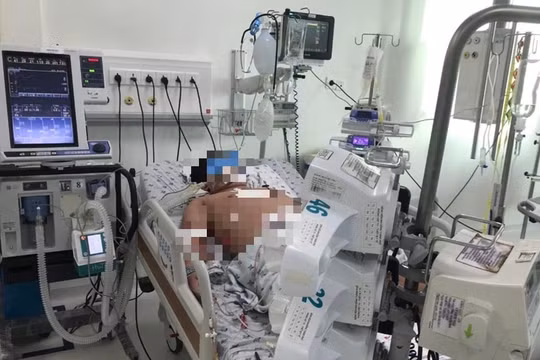 Sốt xuất huyết: Bác sĩ lưu ý không chủ quan khi trẻ có các dấu hiệu sau