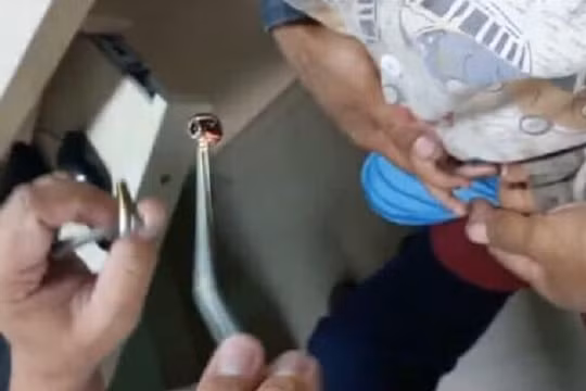 Kon Tum: Phát hiện con vắt dài 6cm trong khoang mũi bệnh nhi 10 tháng tuổi