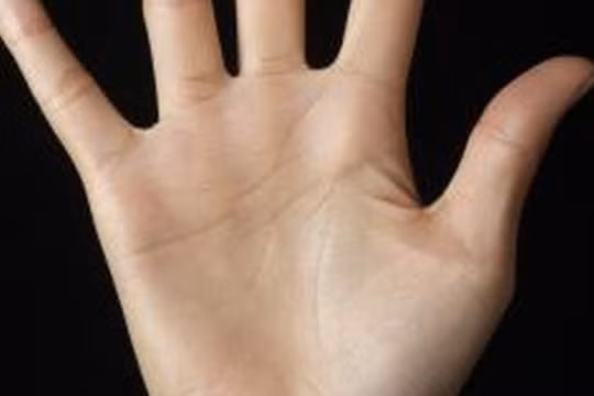 Dự đoán sức khoẻ, vận mệnh qua màu sắc lòng bàn tay