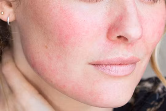 Những thay đổi cơ thể cảnh báo sức khoẻ bạn đang gặp nguy hiểm