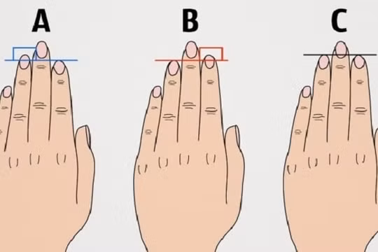 So sánh độ dài ngón tay trỏ và áp út đoán tính cách, sự nghiệp