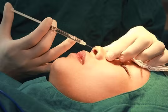 “Sửa tướng đổi vận” theo phong thủy, ẩn họa khôn lường