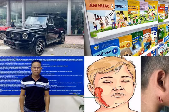 Nóng 18h: Phát hiện trường hợp mắc bệnh "vi khuẩn ăn thịt người" ở Đắk Lắk