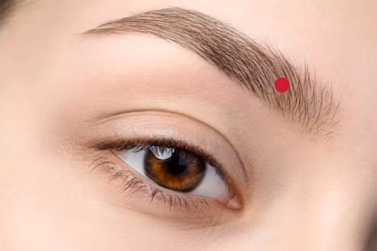 Nốt ruồi ở lông mày là tốt hay xấu?