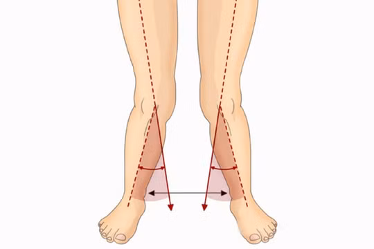 Xem dáng đi dự đoán tính cách vận mệnh sang giàu nghèo khổ