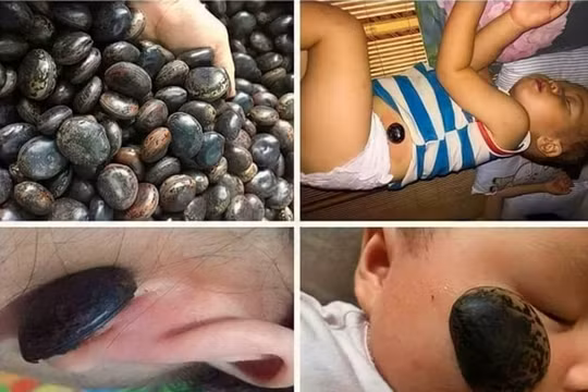 Sự thật về hạt đậu Lào được quảng cáo với công dụng thần kỳ, hút mọi loại độc tố