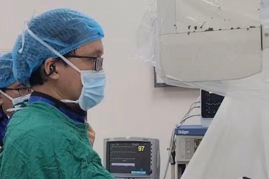Lần đầu tiên tán sỏi túi mật xuyên gan qua da, bệnh nhân xuất viện sau 1 ngày