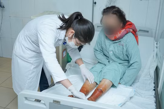 Ngâm chân bằng bột lá không rõ nguồn gốc, một phụ nữ suýt hoại tử hai chân